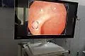 Primi a Catania: arriva l'IA a supporto dell'endoscopia digestiva al Centro Medisan